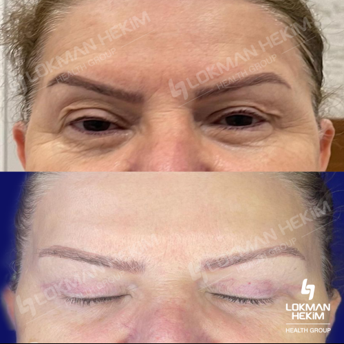 Before after photos of our patients 9